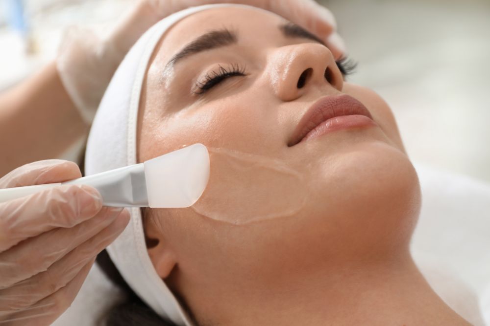 Aplicación profesional de tratamiento peeling químico facial.