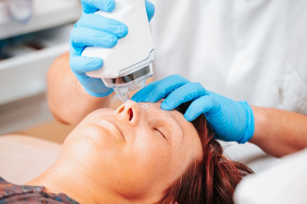 Especialista aplicando tratamiento de láser CO2 fraccionado en la zona facial del paciente