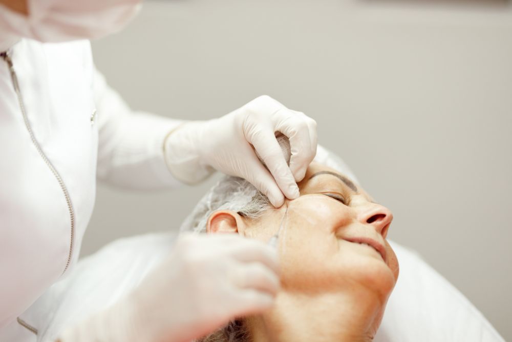 Especialista aplicando tratamiento inyectable de bioestimuladores de colageno en el rostro