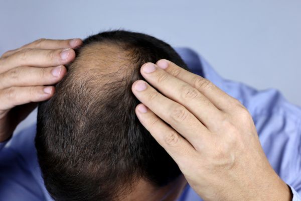 Hombre maduro examinándose la línea del cabello y las entradas frente al espejo