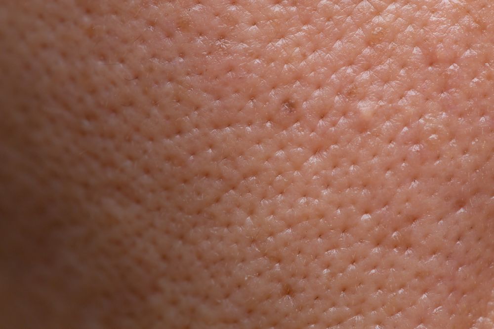 Primer plano de la textura cutánea y poros abiertos en el rostro